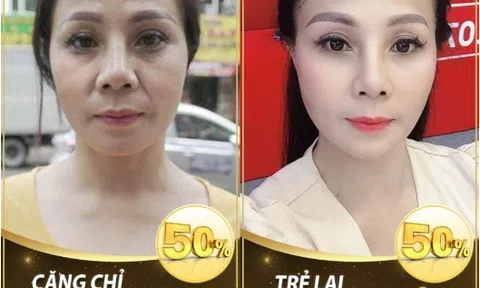 Mãi mãi tuổi thanh xuân với bí quyết nâng cơ trẻ hoá tại thẩm mỹ viện quốc tế Bắc Mỹ
