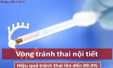 Vòng tránh thai nội tiết MIRENA