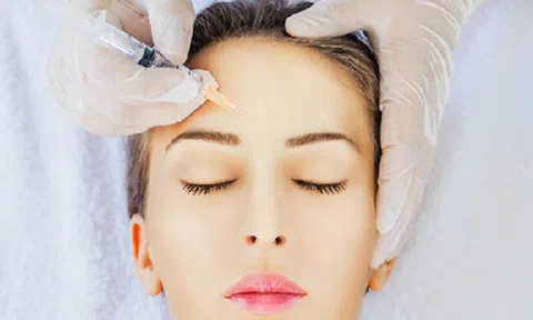 Quy trình chuẩn của phương pháp tiêm filler làm đầy trán