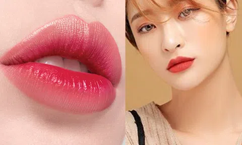 Tác hại của tiêm filler môi hỏng và những lưu ý khi quyết định tiêm filler môi