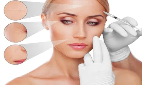 Tiêm filler đuôi mắt là gì? Có gây biến chứng không?