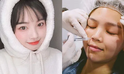Tiêm filler rãnh cười, tại sao nên tiêm filler rãnh cười?