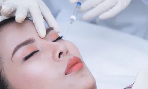Tiêm filler rãnh lệ là gì? Có hại không?