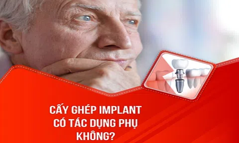 Cấy ghép răng Implant có tác dụng phụ không?