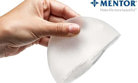 Phương pháp nâng ngực mentor giá bao nhiêu tại Việt Nam?