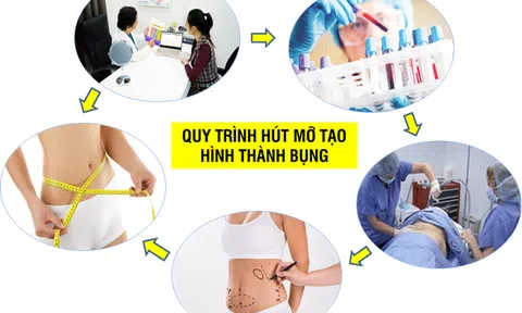 Tìm hiểu phương pháp hút mỡ bụng nội soi tạo hình thành bụng
