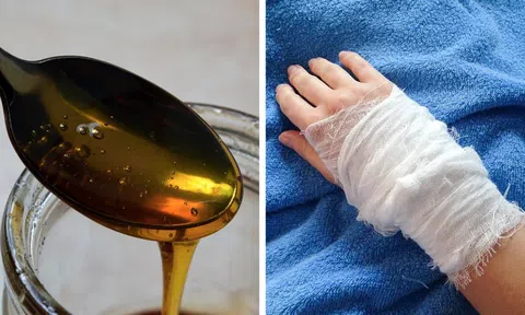 10 cách chữa lành vết thương tại nhà