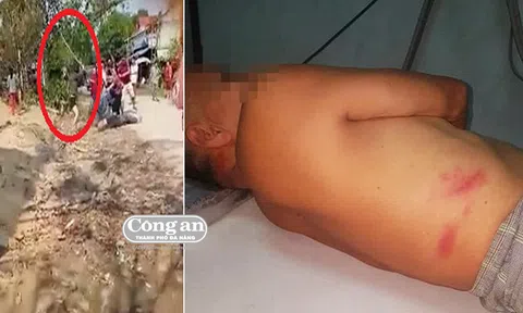 “Đả nữ” cầm cây hành hung ông lão nhập viện