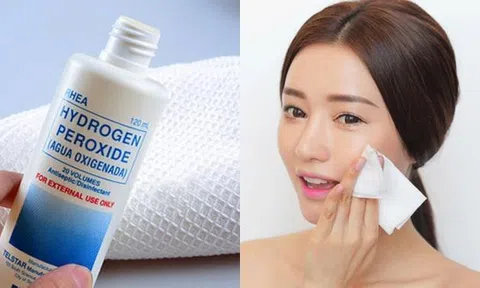 Hướng dẫn sử dụng Oxy già trong điều trị mụn trứng cá tại nhà