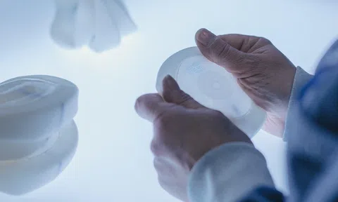 Nâng ngực giữ được bao nhiêu năm? Những thông tin cần biết về tuổi thọ túi ngực?