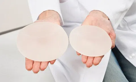 Cập nhật bảng giá nâng ngực nội soi tại Việt Nam 2020
