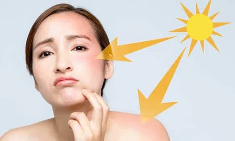 4 Dấu hiệu cho thấy kem chống nắng bạn đang dùng đã bị "hỏng"