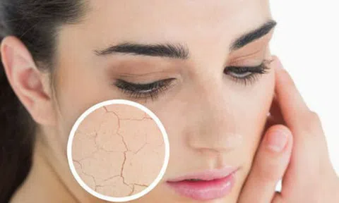 Hướng dẫn chống lão hóa hiệu quả cho từng loại da
