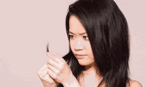 Phòng tránh rụng tóc mỗi khi chuyển mùa hiệu quả, đơn giản nhất hiện nay