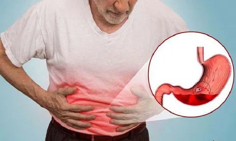 Dấu hiệu cảnh báo dạ dày đang gặp vấn đề nghiêm trọng