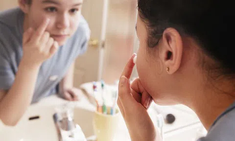 Làm thế nào để loại bỏ mụn trứng cá tuổi dậy thì?