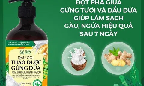 5 cách trị gàu bằng dầu dừa cực hiệu quả tại nhà mà ai cũng có thể áp dụng