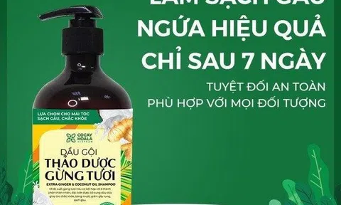 “1001” điều cần lưu ý khi chăm sóc tóc gàu