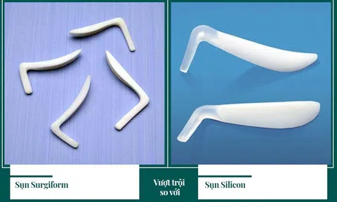 Vì sao chọn Surgiform mà không phải là một chất liệu khác