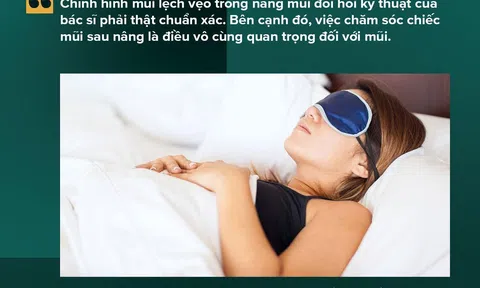 Chỉnh hình mũi lệch vẹo