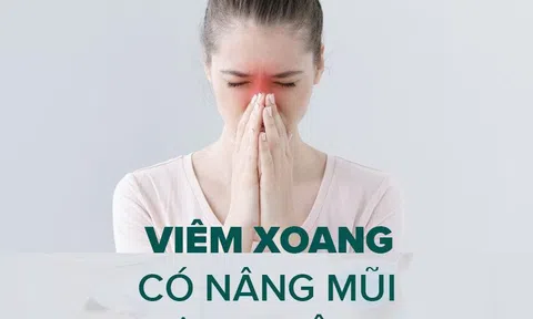 Dr Khải lý giải: “Viêm xoang có nâng mũi được không?”