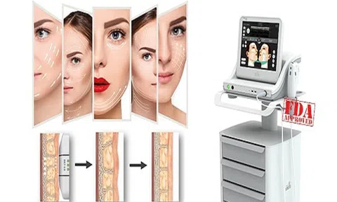 Mãi mãi tuổi thanh xuân- Với bí quyết chống lão hóa hoàn hảo tại thẩm mỹ viện Bắc Âu