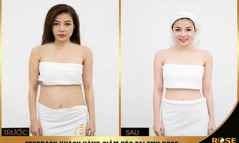 Chính thức ra mắt công nghệ giảm béo anh quốc Smart Burn Fast 2020 Tại Thẩm mỹ viện Rose