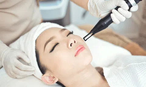 Mẹo giúp bạn phòng ngừa nám da hiệu quả nhất