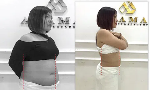 Doanh nhân U40 bật mí cách giảm mỡ bụng nhanh sau 7 ngày