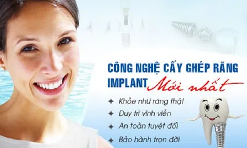 Trồng răng nhân tạo bằng công nghệ Implant Dental