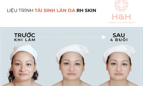 RH - Skin - Thành tựu siêu tái sinh trẻ hoá làn da của Nhật Bản - Lần đầu có mặt tại Việt Nam