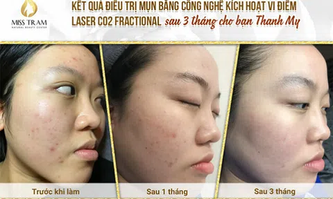 Nên đắp mặt nạ trái cây cho da mụn hay không?