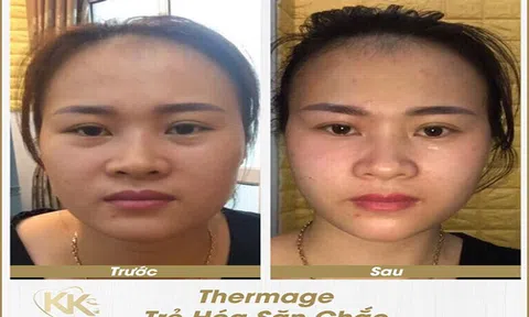 Bác sĩ Ngô Kiều Khanh: 'Thị trường làm đẹp hỗn loạn, không nên ham rẻ mà rước họa vào thân'