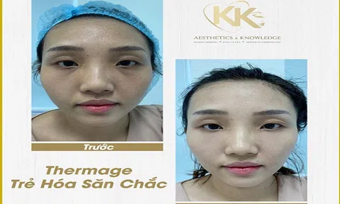 Bác sĩ Ngô Kiều Khanh lý giải tại sao bạn nên can thiệp da lão hóa bằng công nghệ Thermage