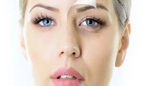 7 mẹo ngăn ngừa quầng mắt thâm đen