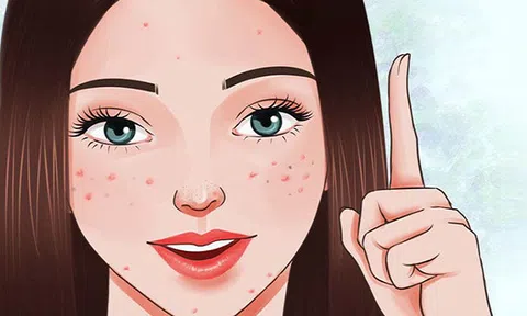 Nắm chắc 7 nguyên tắc khi chọn mỹ phẩm chăm sóc da mụn