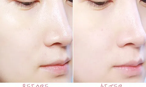 Lười đến mấy da vẫn đẹp lên trông thấy, bí kíp nằm ở chai Nước thần hoa cúc 2in1 Cỏ Cây Hoa Lá