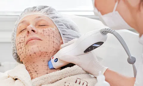 Nguyên nhân xuất hiện nếp nhăn trên mặt và cách khắc phục an toàn