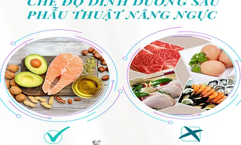 Phẫu thuật thẩm mỹ nâng ngực duy trì được bao lâu?