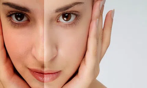 10 nguyên nhân khiến làn da bị xỉn màu