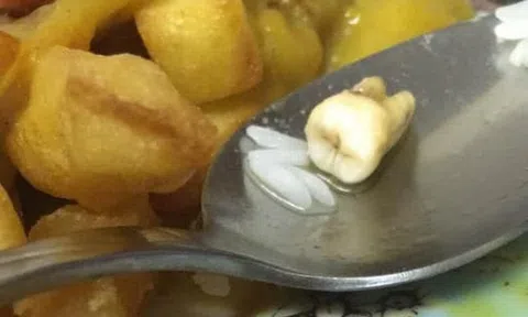 Mỹ: Kinh hoàng phát hiện răng người trong món cà ri của Trung Quốc