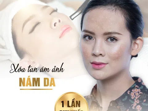 Thẩm mỹ viện quốc tế Bắc Mỹ trị nám uy tín tại Thanh Hóa