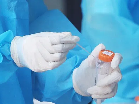 Bộ Y tế đề nghị doanh nghiệp báo cáo giá bán test xét nghiệm Covid-19