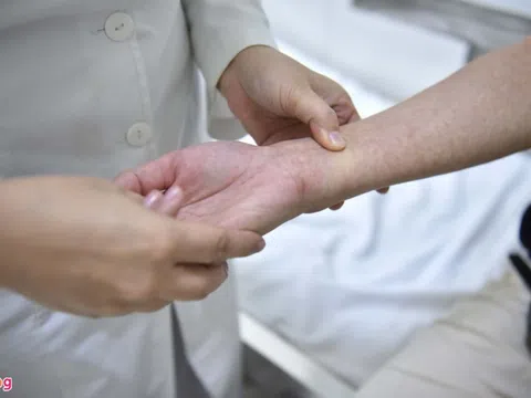 Số ca mắc sốt xuất huyết tại Hà Nội đã tăng hơn 4 lần so với năm trước