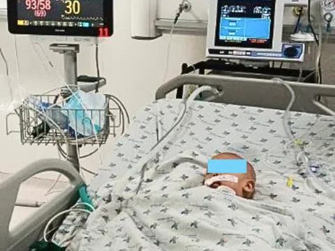 Bác sĩ cảnh báo mối nguy hiểm khi nhiều trẻ bị dị vật đường thở