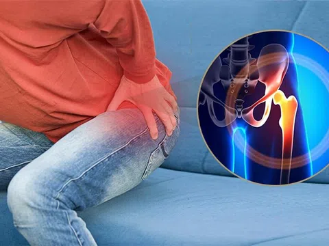 Dấu hiệu thoái hóa khớp háng