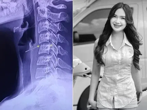 Nữ ca sĩ xinh đẹp tử vong vì massage cổ vai gáy