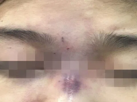 Bi hài chuyện "dao kéo" đổi vận: Thầy "phán" mũi "xấu", cô gái nâng cấp "thần tốc" rồi chuốc tai họa