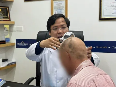 Rụng tóc mảng cả đầu, bác sĩ cảnh báo sai lầm nguy hiểm