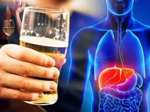 Dấu hiệu gan tổn thương do uống nhiều rượu bia